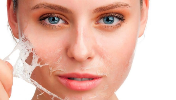 تجديد البشرة بالتقشير الكيميائي