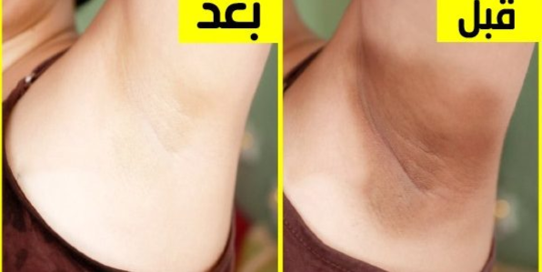 تفتيح المناطق الحساسة